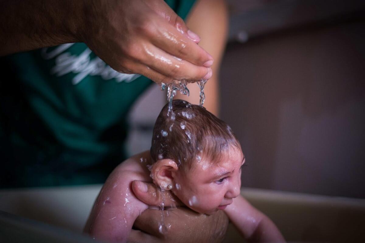 Ana Beatriz, a Brazilian baby born with microcephaly, at 4 months. In a new report, researchers say they have isolated the Zika virus in the brain of a fetus aborted after a sonogram at 29 weeks found it to have microcephaly.