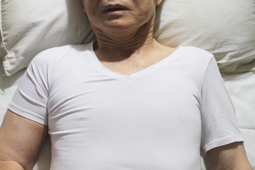 Former Peruvian President Alberto Fujimori is shown lying in bed in prison.