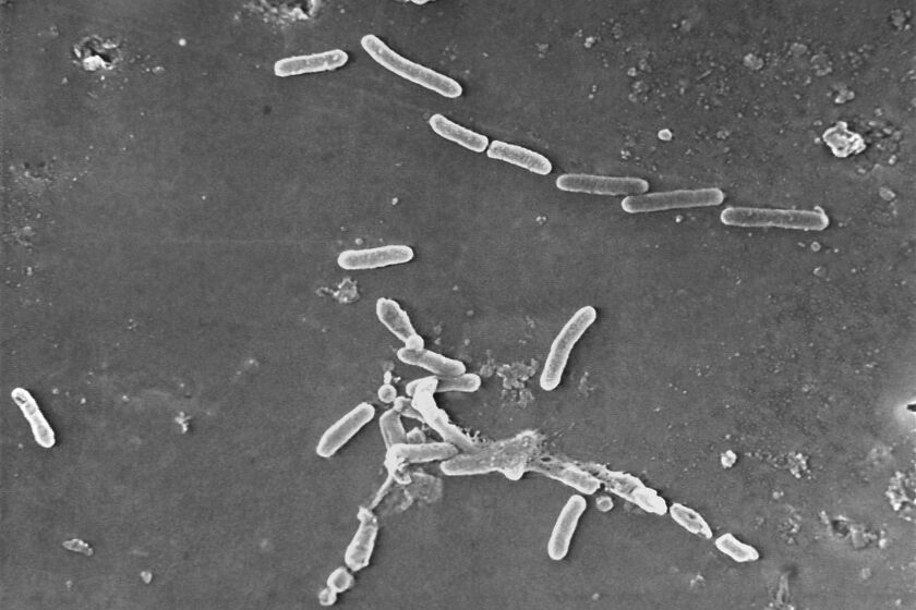 Esta imagen de microscopio electrónico proporcionada por los Centros para el Control y la Prevención de Enfermedades de EE.UU. muestra la bacteria Pseudomonas aeruginosa. (Janice Haney Carr/CDC vía AP, Archivo)