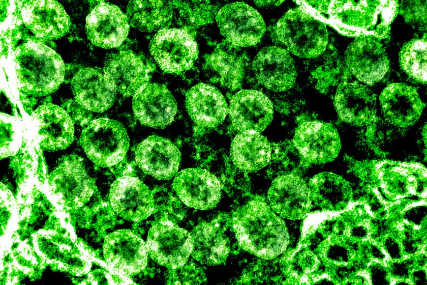 Transmission electron micrograph of virus particles of the new coronavirus, isolated from a patient.