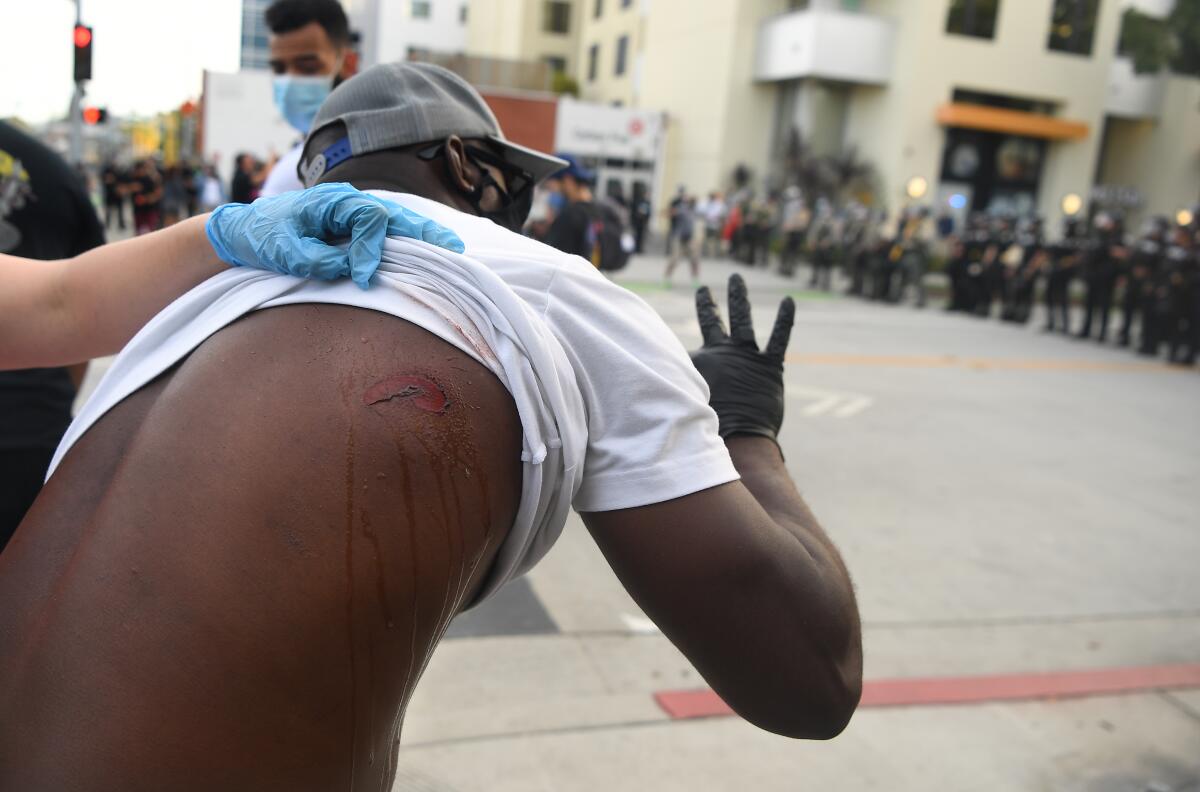 A protester is treated for a wound after being struck by a rubber bullet in Santa Monica