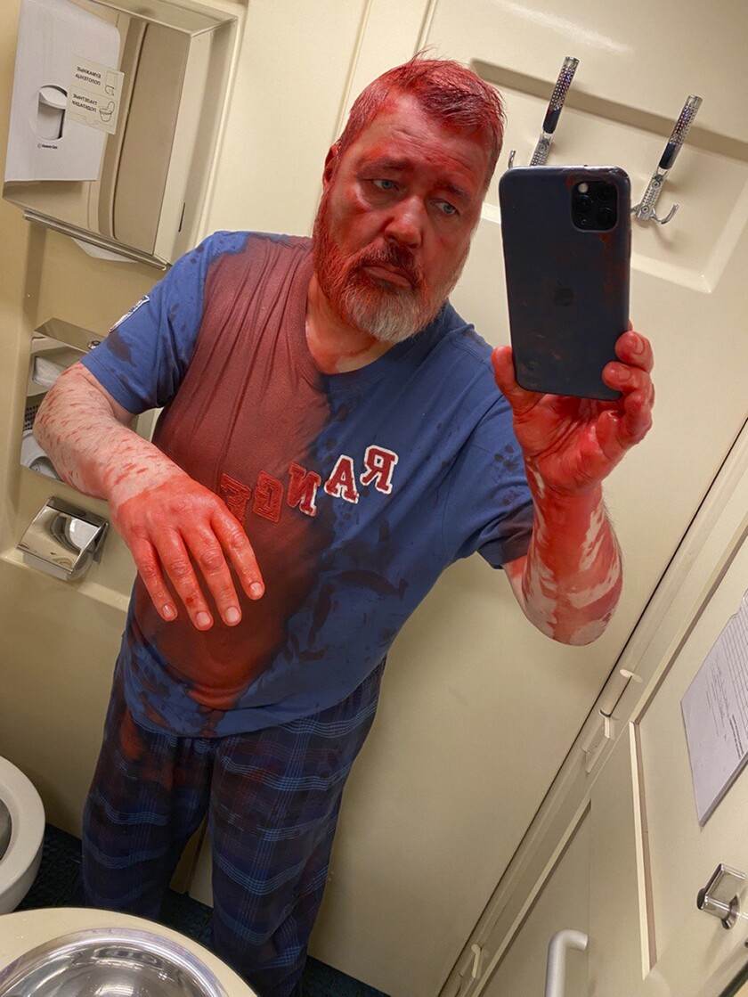 In this photo published on Novaya Gazeta Europe's Telegram channel, Nobel Peace Prize-winning newspaper editor Dmitry Muratov takes a selfie after he said he was attacked on a Russian train by an assailant who poured red paint on him, causing his eyes to burn severely, Russia, Thursday, April 7, 2022. Muratov told Novaya Gazeta Europe, a project launched by newspaper staff after the paper suspended operation last week under government pressure, that the Thursday assault happened on a train heading from Moscow to Samara. (Novaya Gazeta Europe's Telegram channel via AP)