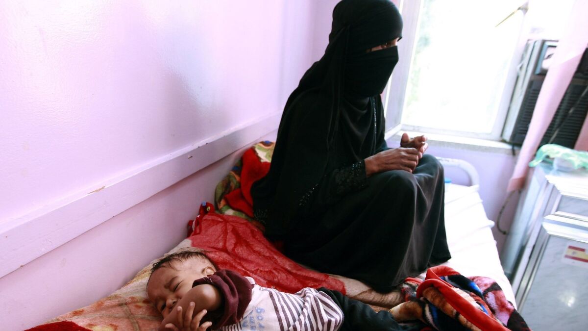 A Yemeni mother sits next to her malnourished infant at a therapeutic feeding center in the capital, Sana, on Jan. 2, 2016.
