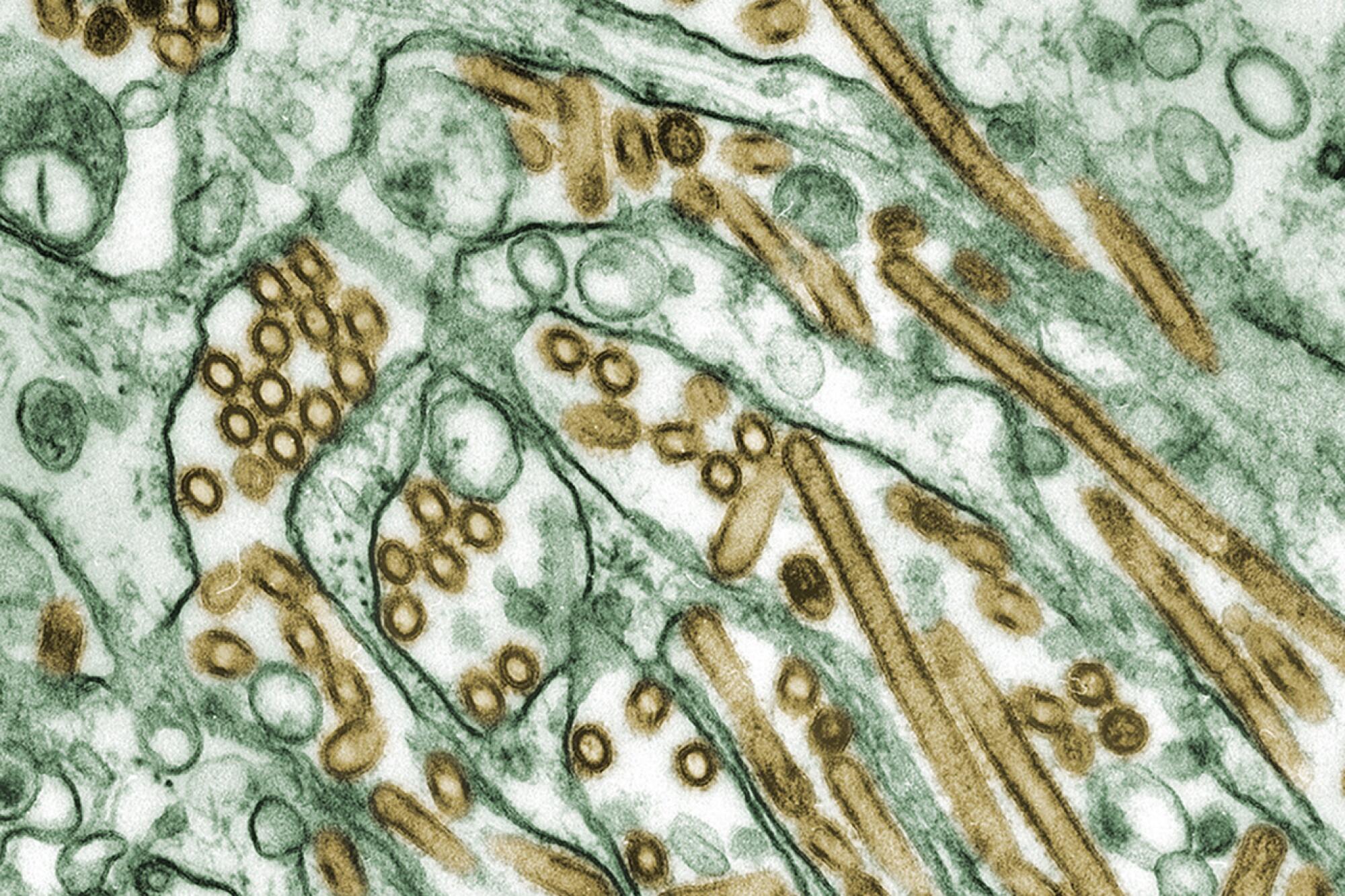 A microscope image of H5N1 virus particles 