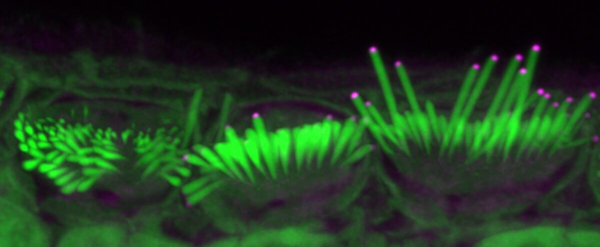 Stereocilia (green) of the inner ear, which transduce sound, are shown treated with the protein EPS8 (magenta) in mice.
