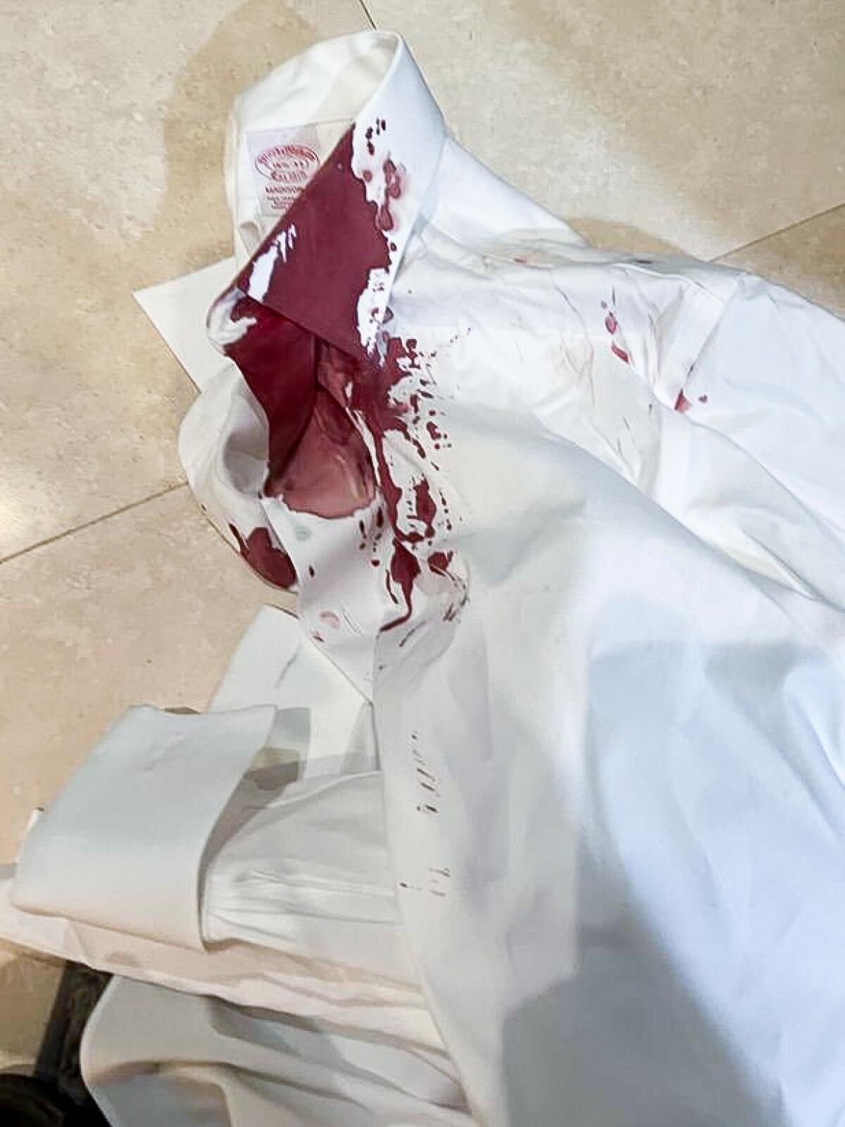 The bloodied shirt that Raphael Nissel was wearing when he was attacked on a Beverly Hills street.