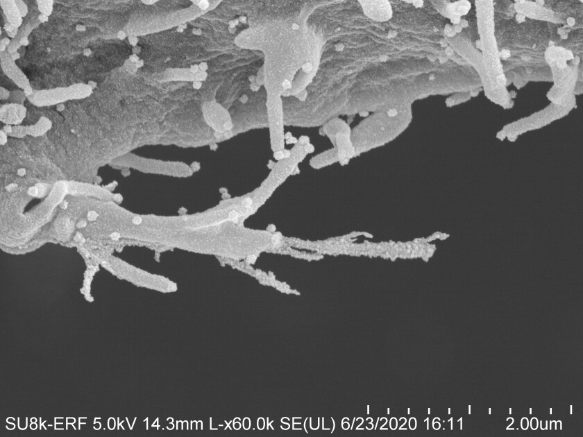 Tendrils reach out from a coronavirus-infected cell.