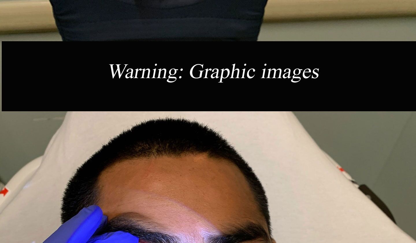 Warning to our readers: Graphic images