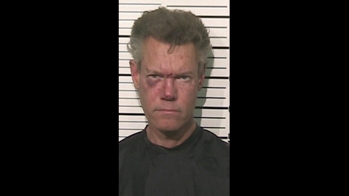 Randy Travis is bruised up in a mug shot taken after he was arrested Aug. 8, 2012, on suspicion of DWI and a third-degree felony count of retaliation. He was naked when he was arrested.
