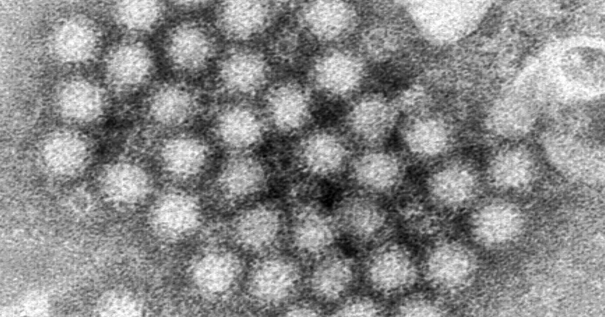 Plus de 100 passagers sont morts du norovirus sur un bateau de croisière en provenance de Californie