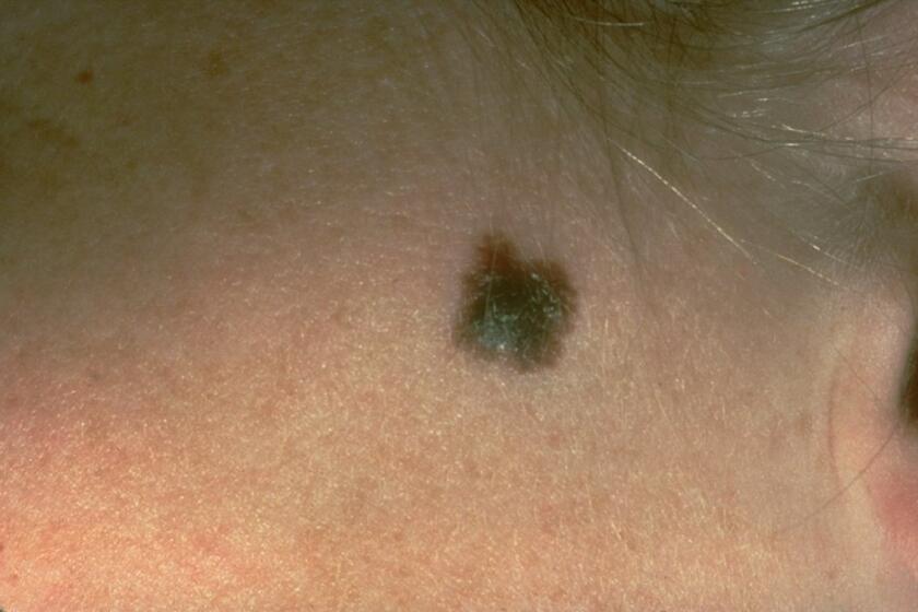 Should a physician screen for moles and other skin abnormalities that could be cancer? Experts say the jury's still out.