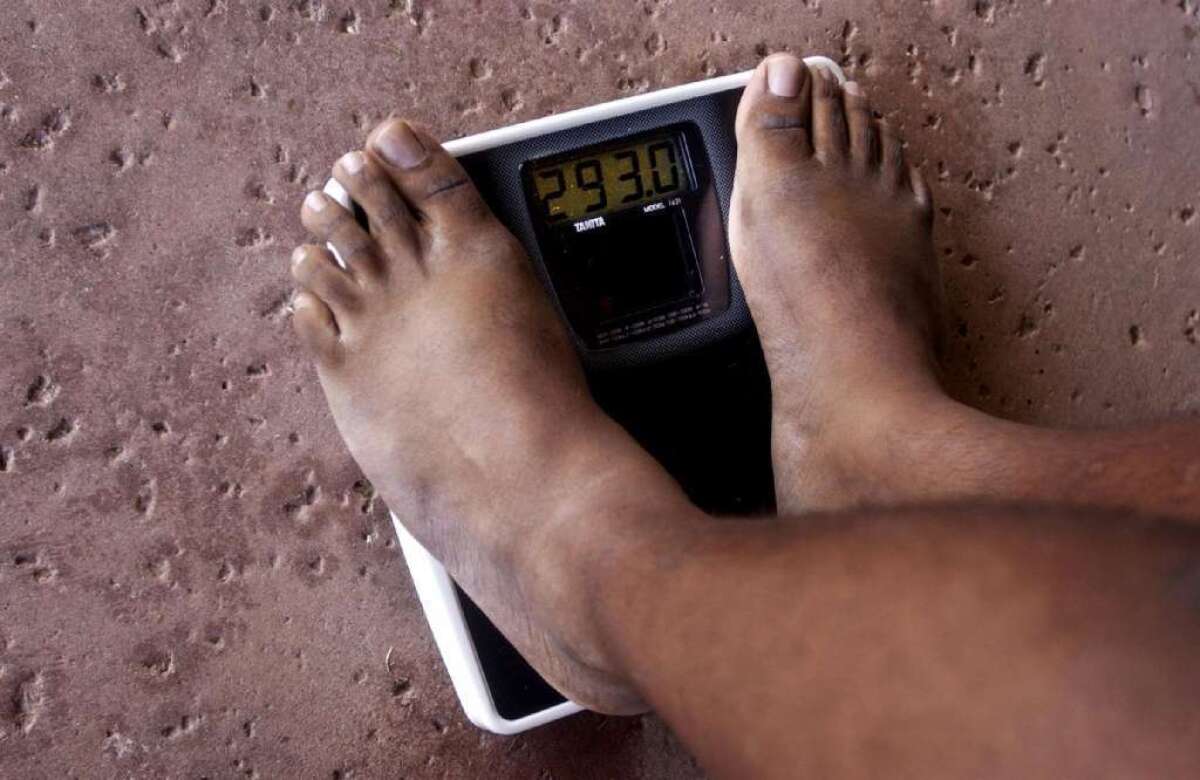 An Irish study has found that men and women are increasingly underestimating their weight.