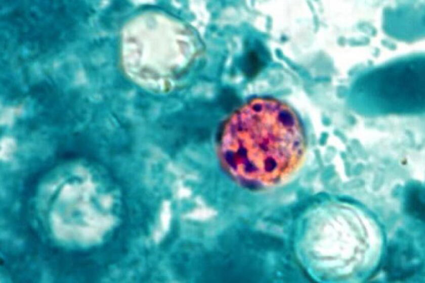 Image 11: Cyclosporiasis is an intestinal infection that spreads when people ingest food or water contaminated with stool. Cyclospora cayetanensis is a unicellular parasite that causes an intestinal infection called cyclosporiasis. Because Cyclospora is a coccidian parasite, infected people shed oocysts (rather than cysts or ova) in their feces.