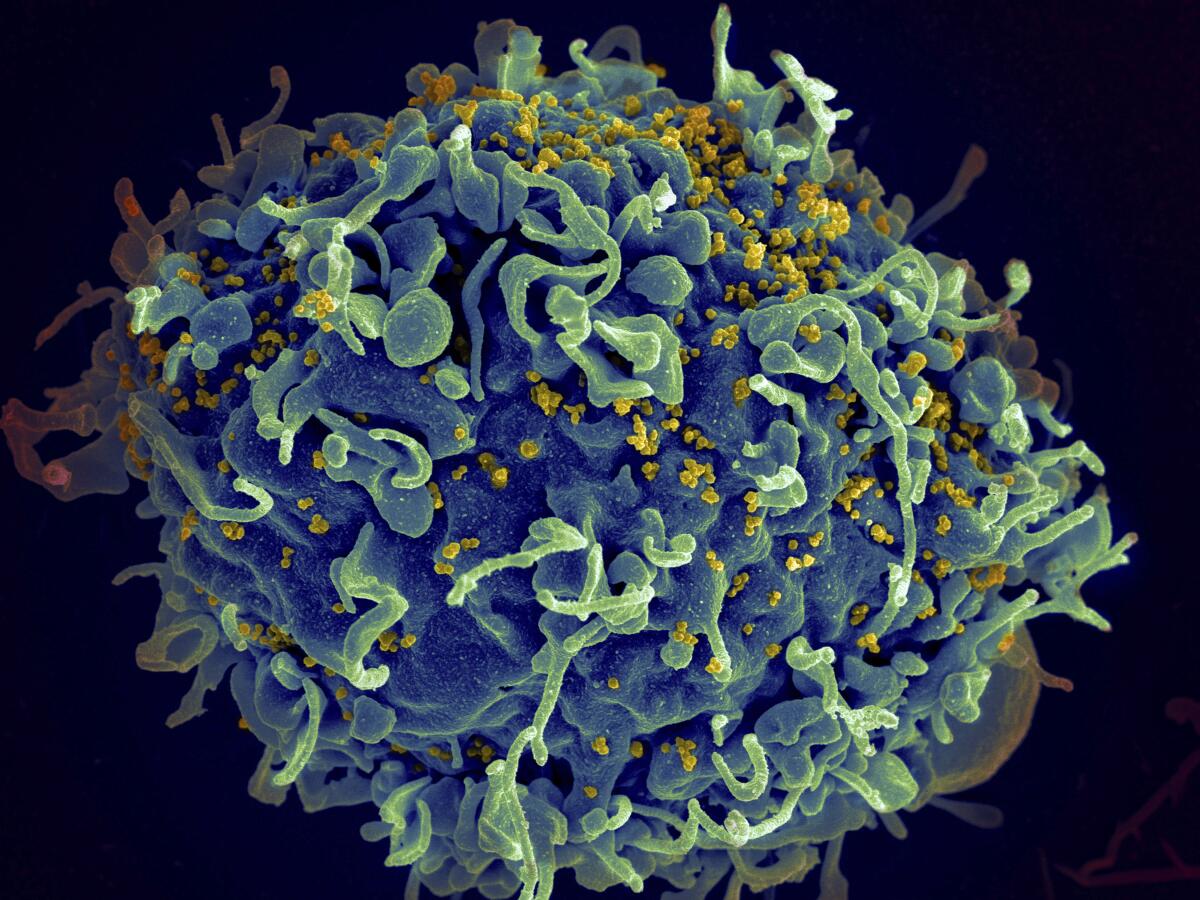Una célula T, en azul, siendo atacada por el VIH, el virus que causa el sida, en amarillo. 