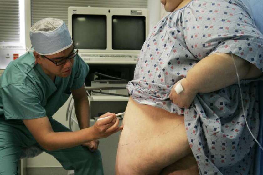 Dr. Carson Liu outlines skin flap on a patient just before removing over 48 pounds of skin and fat in a lap–band surgery in 2006. The patient had weighed over 500 pounds. A new study examines the link between bariatric surgery and mental health.