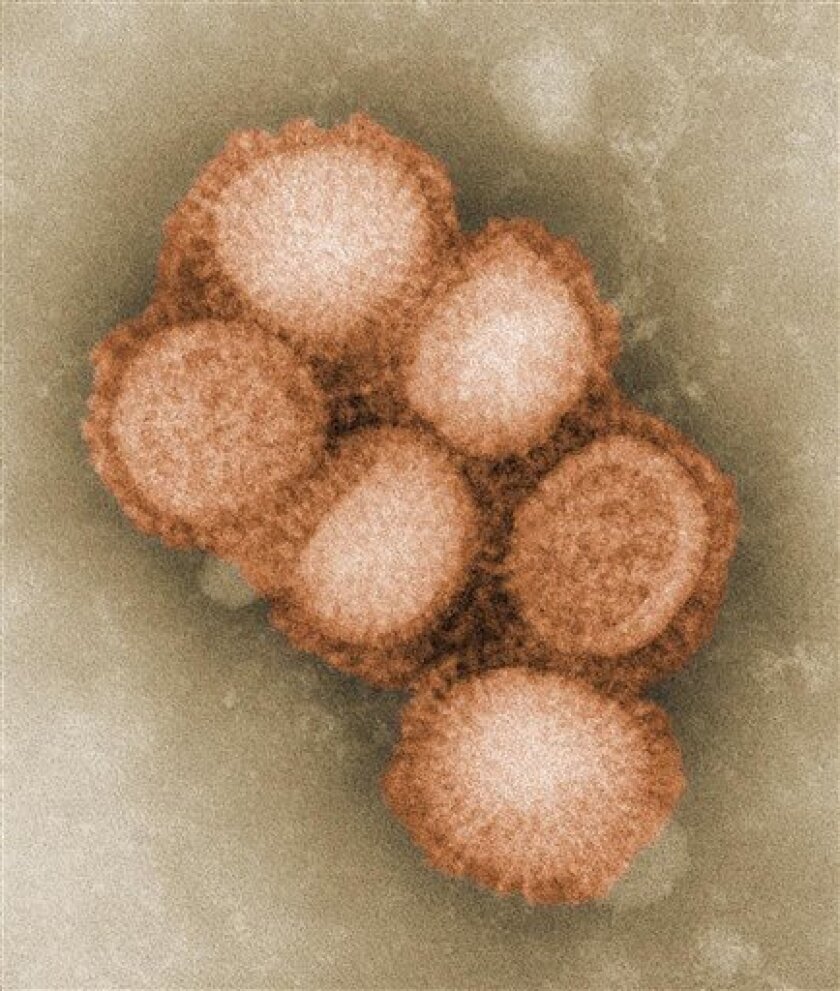 A negative-stained image of the swine flu virus. 