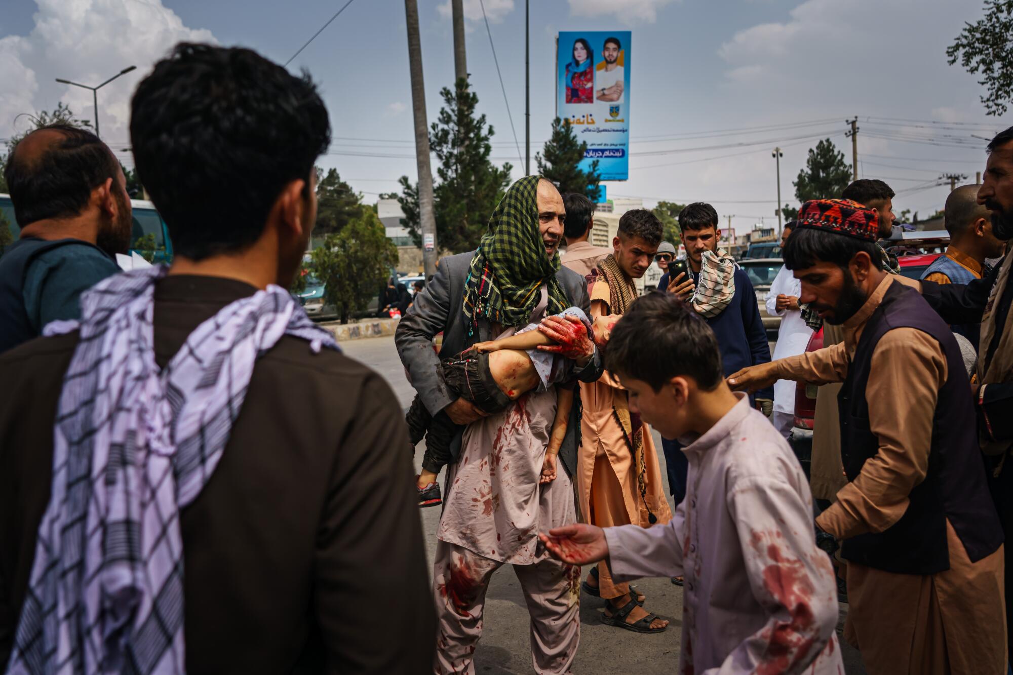 A man in a blood spattered tunic carries an injured child in his arms through a crowd