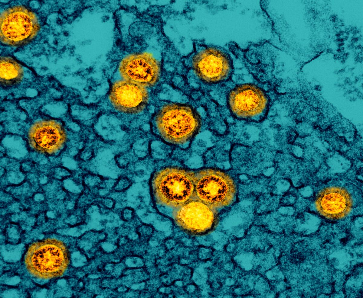 Omicron virus particles replicating inside an infected cell in an image from a transmission electron microscope.