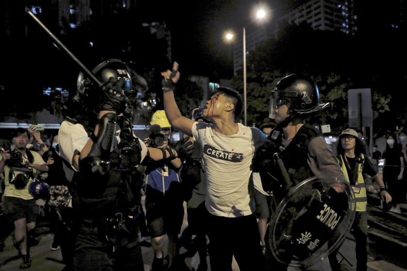 A bleeding man reacts as he is taken away by policemen after attacked by protesters outside Kwai Chung police station in Hong Kong, Wednesday, July 31, 2019. Protesters clashed with police again in Hong Kong on Tuesday night after reports that some of their detained colleagues would be charged with the relatively serious charge of rioting. (AP Photo/Vincent Yu)