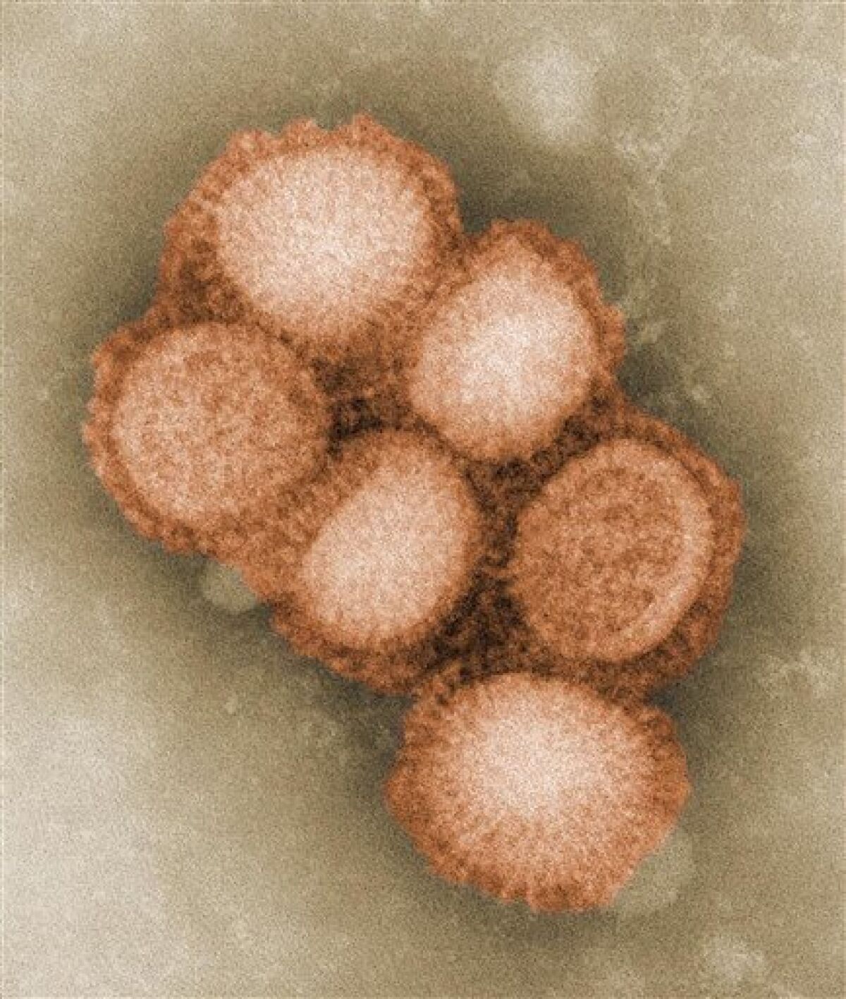 A microscope image of the swine flu virus from 2009.