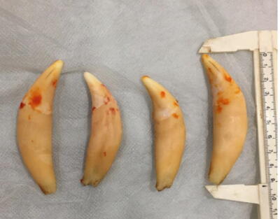Anaheim couple trafficked endangered wildlife parts, including bear gallbladders and lion teeth, feds say