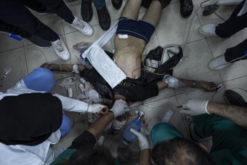 Palestinos heridos en el bombardeo israelí en la Franja de Gaza son trasladados al hospital Al Najjar de Rafah, en la Franja de Gaza, el sábado 24 de febrero de 2024. (AP Foto/Fatima Shbair)