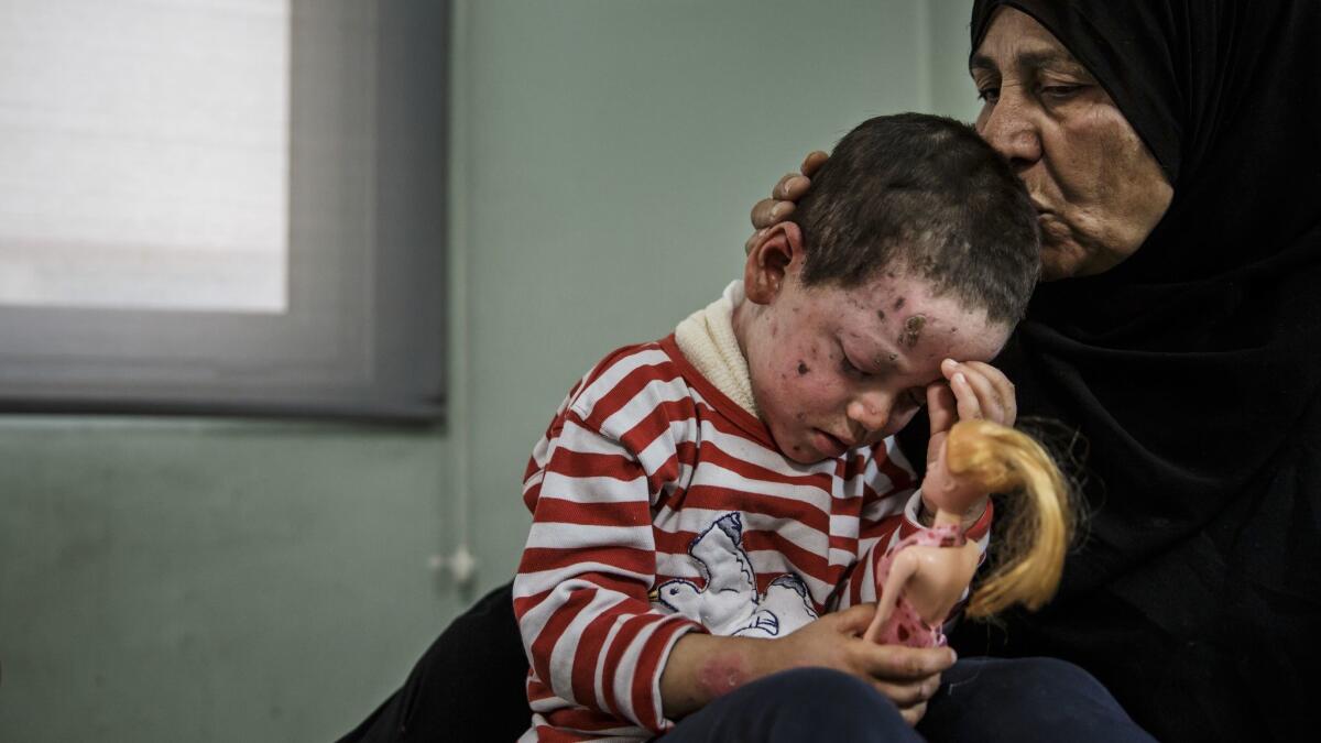 Aliya Ismail kisses her granddaughter Hawra Hasan, 4, who suffered shrapnel wounds from a March 17 coalition airstrike that destroyed her home and killed her mother.