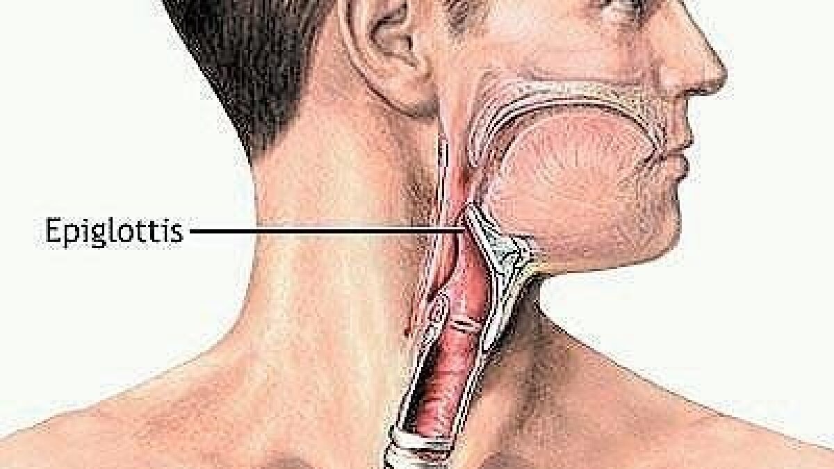 The flap about the epiglottis - San Union-Tribune