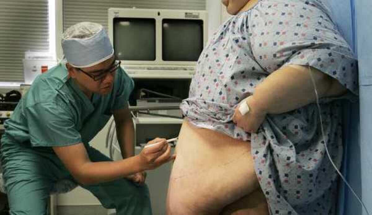 A patient gets prepped for weight-loss surgery.