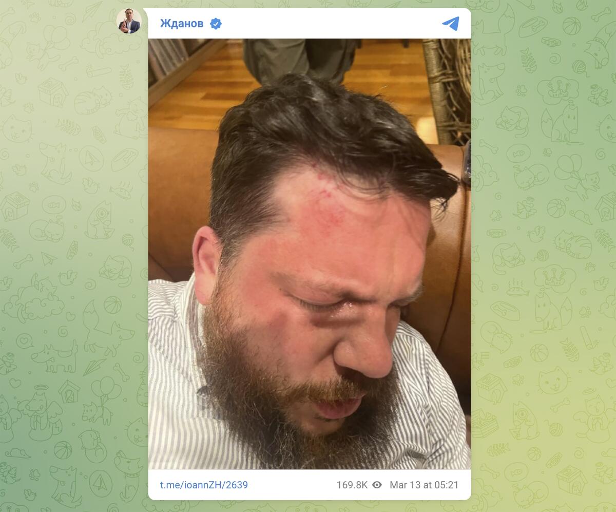 An image from social media shows Leonid Volkov's swollen face.