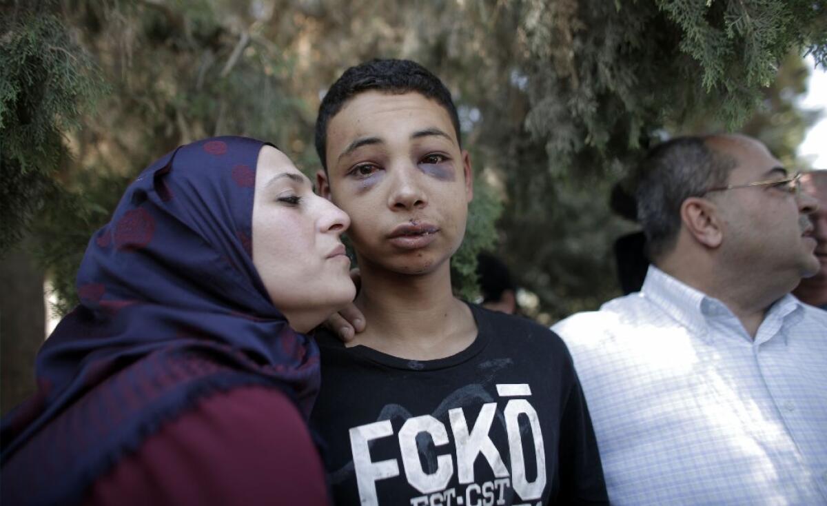 Tariq Abukhdeir, is embraced by his mother after a court hearing in Jerusalem.