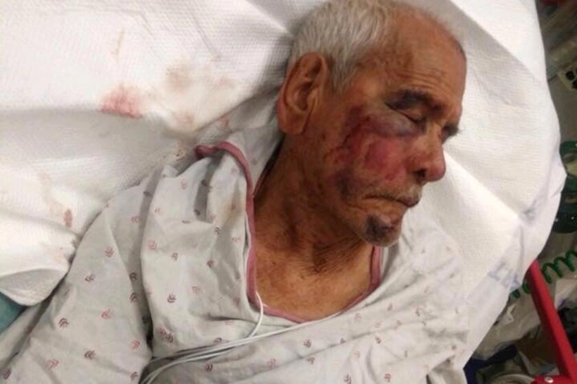 Rodolfo Rodriguez, 92, was beaten with a brick while on his daily walk around his neighborhood on July 4.