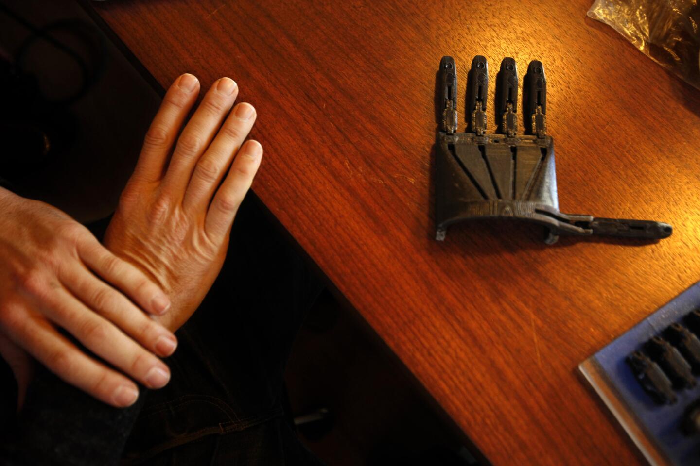Mick Ebeling, founder and chief executive of Not Impossible, rests his hands next to a prosthetic hand he created with a 3-D printer at his office in Venice. Besides making prostheses, the group developed EyeWriter, a pair of glasses affixed to a Web camera that enables people to draw on a computer with their eye movements.