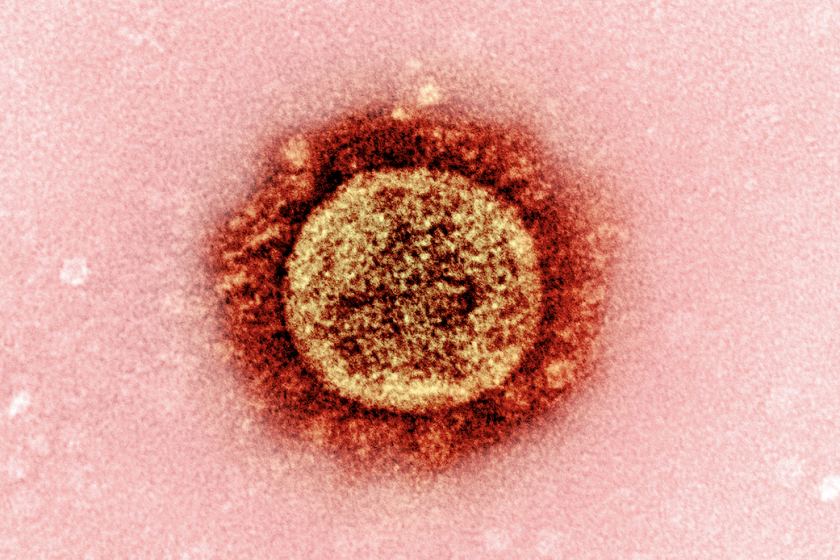 A specimen of the B.1.1.7 coronavirus variant from the United Kingdom is seen under a microscope.