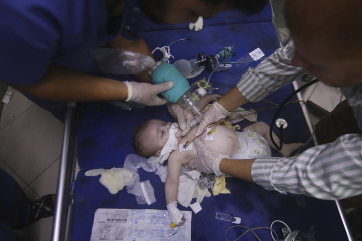 Un bebé palestino herido por bombardeos de Israel es atendido en el hospital de Al-Najar, en Rafah, 