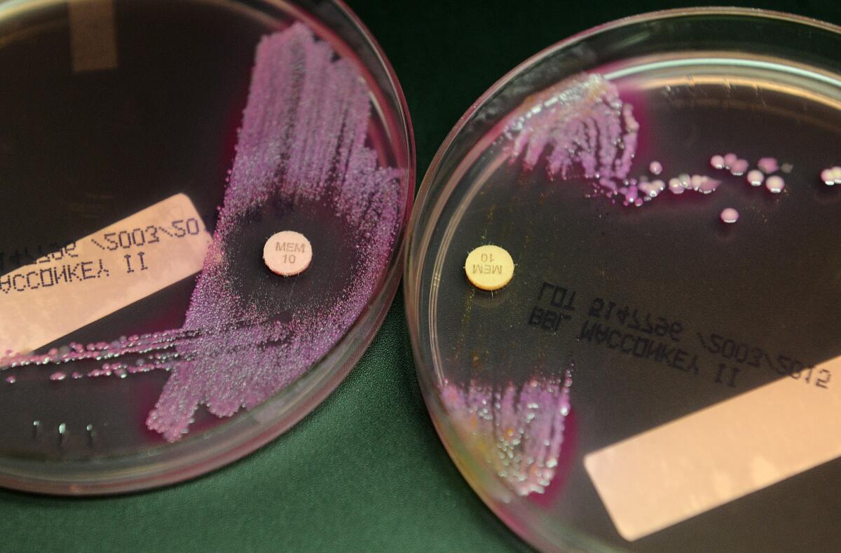A bacterial sample at left contains carbapenem-resistant Enterobacteriaceae, able to grow despite the presence of an antibiotic.