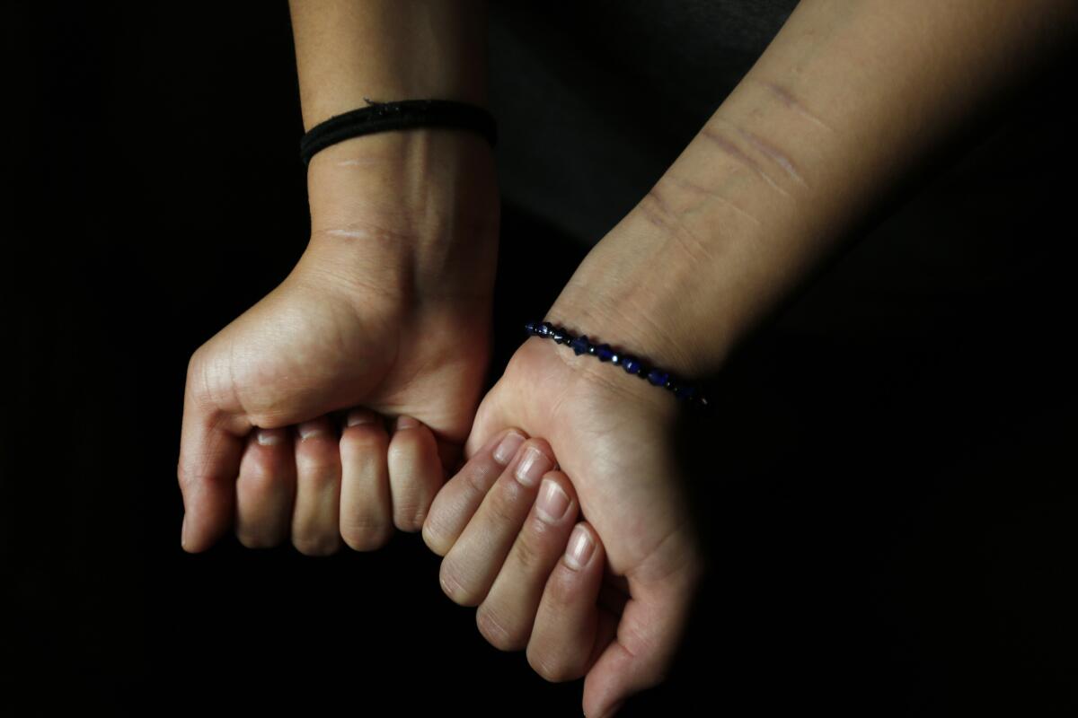 A teenager shows her scarred wrists.