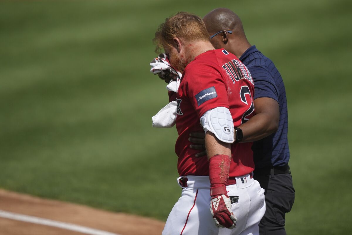 Boston's Justin Turner is helped off the field after taking a pitch to the face against Detroit in spring training Monday.
