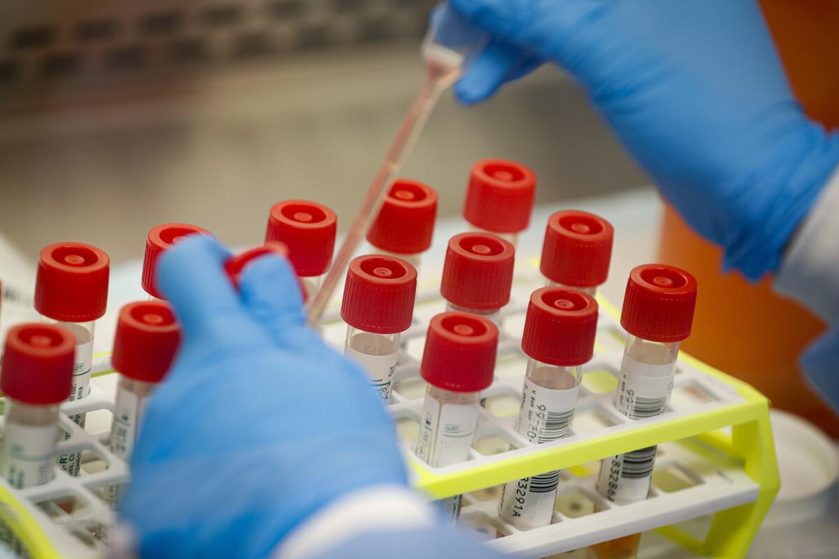 A technician prepares COVID-19 coronavirus patient samples for testing at a laboratory.