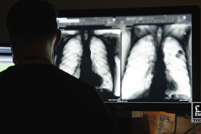 LA Times Today: Inside the V.A.’s heroic efforts to find a cure for lung cancer