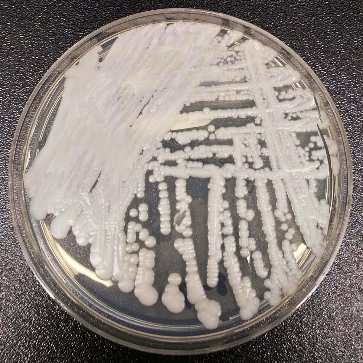 FILE - This 2016 photo made available by the Centers for Disease Control and Prevention shows a strain of Candida auris cultured in a petri dish at a CDC laboratory. A hospital in New Orleans says, Wednesday, Jan. 19, 2022, it has identified two patients infected with a rare, drug-resistant fungus — the first time it's been found in Louisiana. Candida auris has already been found in Washington, D.C., and at least 20 other states including Georgia, Florida and Texas, according to the Centers for Disease Control and Prevention. The fungus is a harmful form of yeast that can be resistant to the most common antifungal drugs. (Shawn Lockhart/CDC via AP)