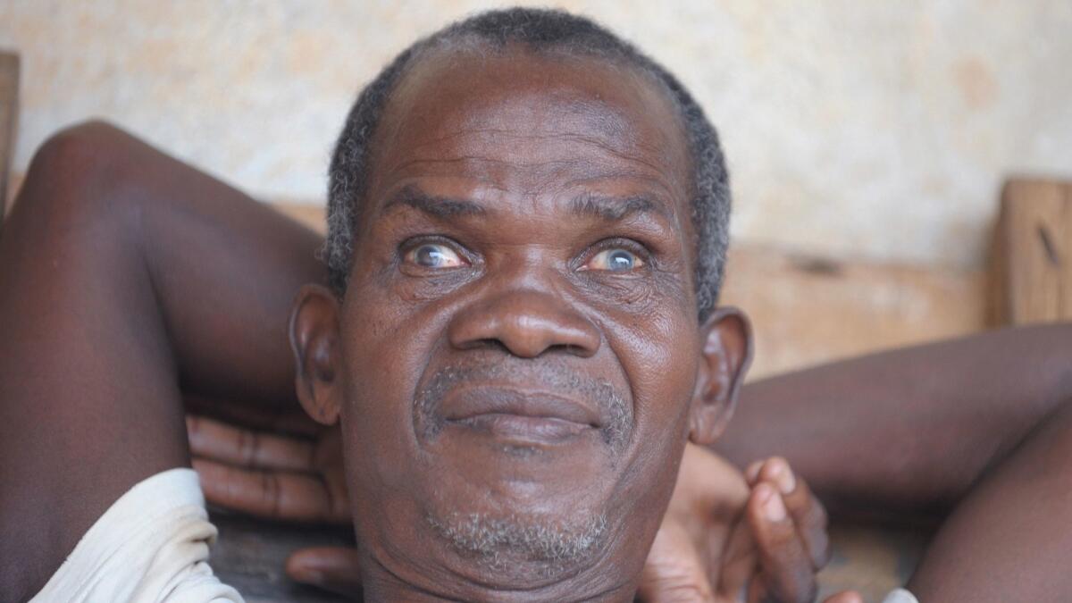 A 2008 photo shows a blind man suffering from onchocerciasis, or river blindness, in the Ivory Coast town of Kouadioa-Allaikro.