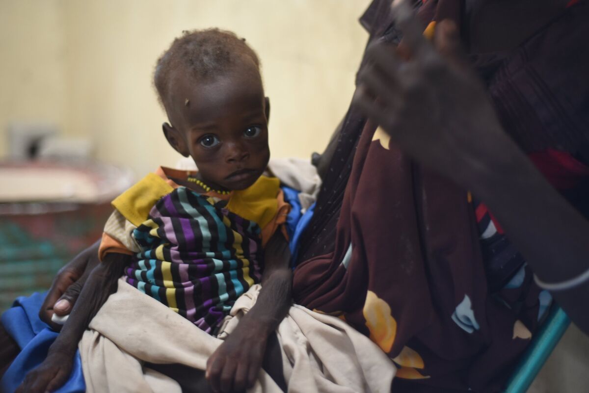 Nyagoah Taka Gatluak, a severely malnourished 1-year-old, sits on her mother's lap at the Doctors Without Borders clinic in Leer, South Sudan, on Dec. 15, 2015.