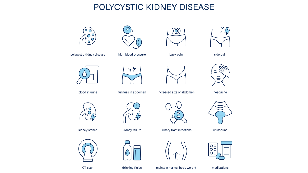 Polycystic Kidney Disease symptoms, diagnostic and treatment vector icons. Medical icons.