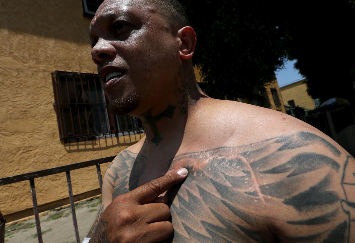 Dexter White shows off a scar from getting shot by LAPD officers in 2018.