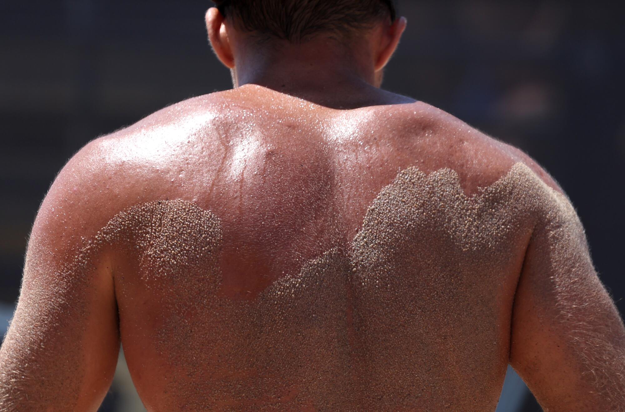 A man sweats with sand on his back while playing beach volleyball.