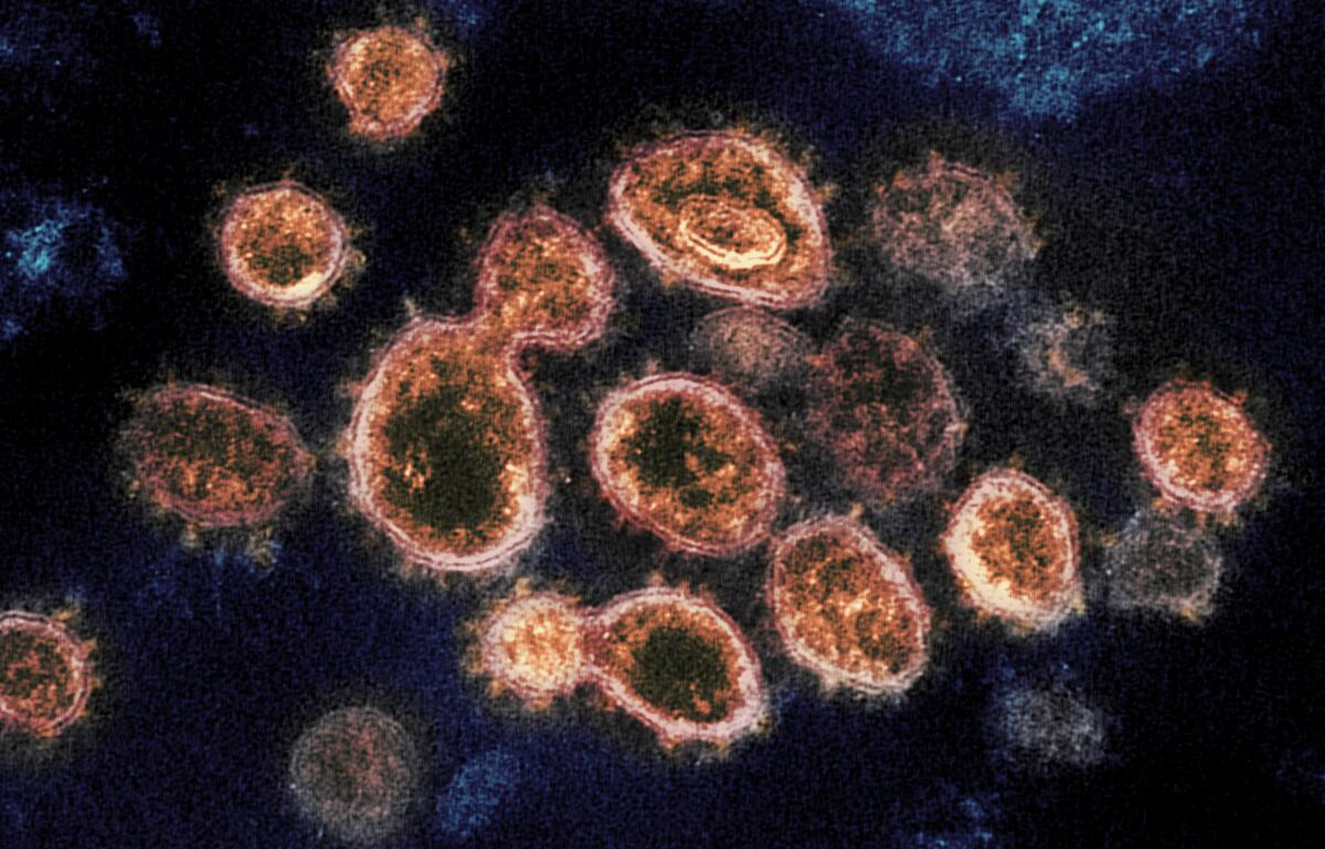 SARS-CoV-2 virus particles on the surface of cells cultured in a lab. 