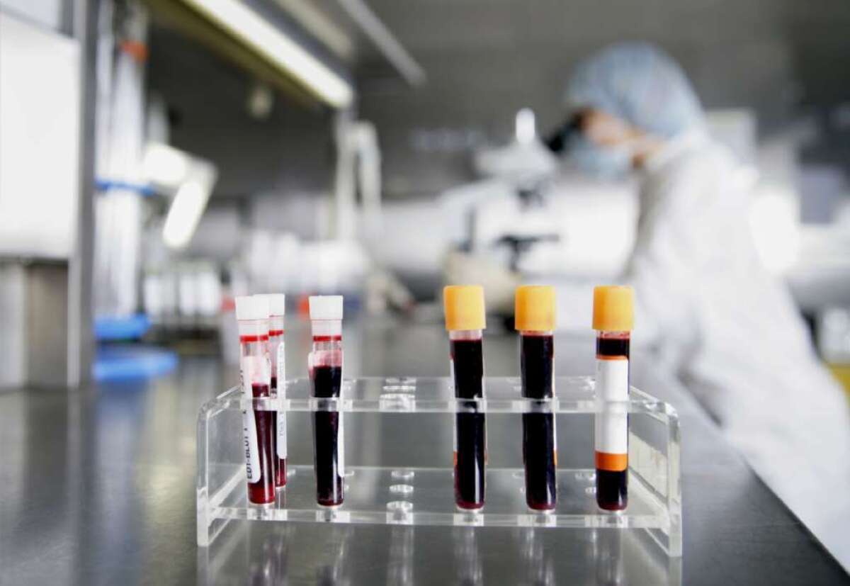 Doctors should stop screening most women for ovarian cancer, according to new guidelines from the American College of Physicians. That means no more blood tests to check for a biomarker known as CA-125.