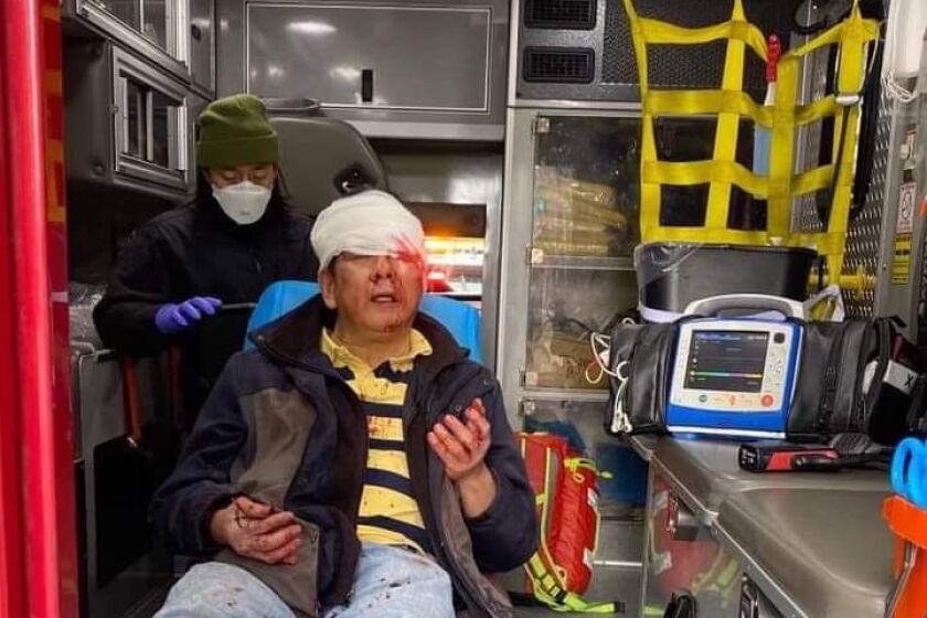 Danilo Yuchang, 59, sits in an ambulance with a white bandage around his head.