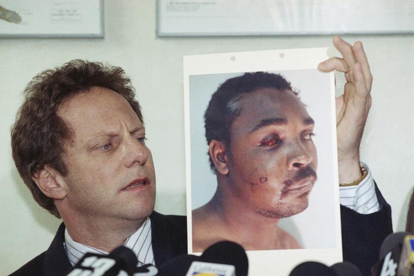 Steven Lerman, attorney for Rodney King, displays a photo of his client during a press conference at his office in Beverly Hills on March 8, 1991. King's doctor outlined the extent of the man's injuries for reporters during the meeting.